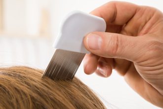 Can bed bugs live in your hair? Heres The Answer